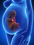 baby formula may be behind premature infant cases of Necrotizing Enterocolitis